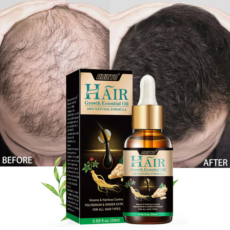 2023 Biotin Fast Hair Growth O - Licorice Root Sticks ulasan dan harga